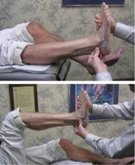 Fully extend the knee. Dorsiflex the foot, and measure the angle of dorsiflexion at the ankle. Next, flex the knee to 90 degrees and repeat the measurement. If there is less dorsiflexion when the knee is extended, this indicates a gastroc equinus,...