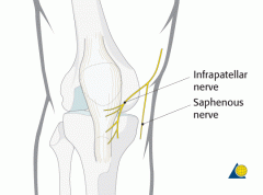 saphenous nerve block