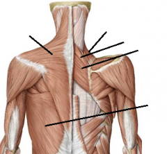 Superficial back muscles 