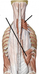 Intermediate back muscles- names and innervation