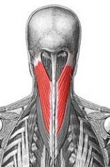 Superficial Intrinsic Back Muscles: Splenius Capitis (splenii)