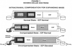 Monro-Kellie doctrine