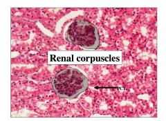 Renal corpuscle = glomerulus + Bowman’s capsule 


						These are all in the cortex and are surrounded by the proximal and distal
convoluted tubules. Each kidney has between 200K – 2 million glomeruli.