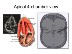 Answer A or B
The anterior leaflet is close to the inter-atrial septum, the posterior leaflet is lateral