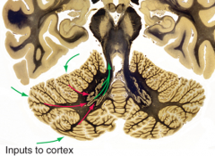 Input stim causes inhibition of deep cerebellar nuclei which causes mostly output stim

input (stims) - cerebellar cortex (inhibits - w/GABA) - deep cerebellar nuclei (which mostly stim) - output targets