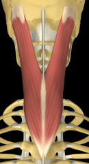 O: Lower half of ligamentum nuchae, spinous processes C7-T4
I: Mastoid process of skull
I: Posterior (dorsal) rami, middle cervicle nerves
A: Together -Draw head backward, extending neck 
Individually - rotate head side to side
B: Branches of occipit