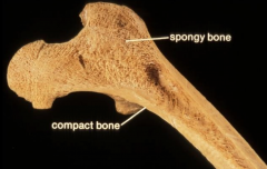 1) Adult bone where matrix is laminated. Is very dense. 
2_ Filled with spaces, contain bone marrow in long bone - either red hemopoietic cells or yellow fat.