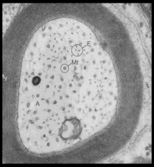 Contain microtubles and neurofilaments. 
Or neurokeratin - which is the cytoskeleton of the axoplasm
-black rings are myelin - lipid - perserved with osmium