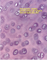 Are matured chondroblasts located in lucanue of cartilage. Mitotic division leads to group of 4-8 chondrocyte reffered to Isogenous groups or cell nest.