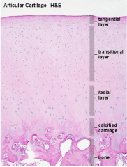 Hyaline cartilage at joints which do not contain perichondrium.