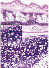 Ear, auditry canal, ear tube, epiglottis 
Type II collagen and ELASTIC FIBERS
NEVER CALCIFIES 
Matrix identical to hyaline, but contains elastic fibers 
Support and flexibility