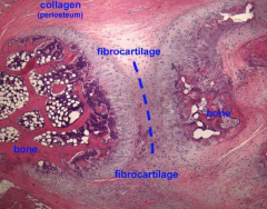 Invertebral disc (annulus fibrosis), attachment of ligament to bone, articular discs, pubic symphysis 
TYPE I Collagen but does contain Type 2
GAGS - mainly chondroiti
ONLY INTERSITIAL GROWTH - NO PERICHONDRIUM
SUPPORT and tensile strength