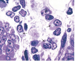Flattened membrane bound that are enclosed in cistern
Has cis face (entry face) and trans face (exit) 
-Are well developed in secretory cells (plasma cells - pancreatic acinar cells) 
CGN - cis golgi network