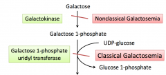 Is a deficiency of GALT (galactose 1-phosphate uridyl transferase). 
This results in accumulation of galactose of 1-phosphate, this causes back flow and accumulation of galactose in blood. This will results in loss of galactose in the urine. 
Accumulati