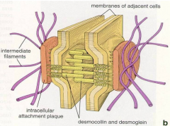 Has dense plaques on the cytoplasmic side. With desmogleins and E-cadherin transmembrane glycoproteins. 
There are intermediate (keratin) filaments that loop into and out of the plaques. 
Are transmembrane links that help stabilize the structure.