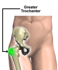 anatomical part of the femur connecting to the hip bone