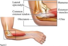common extensor tendons