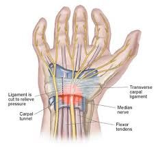 - flexor tendons
- median, ulnar, and radial nerves
- major blood vessels
*carpal tunnel