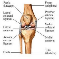 medial collateral ligament 
aka
tibial collateral ligament