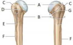 What are the names of features labeled on this photo of the Humerus?