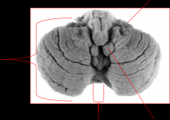 Name the parts of the cerebellum
(caudal view)