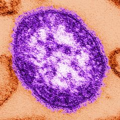 Measles
(Paramyxovirus)