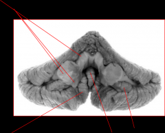 Name the parts of the cerebellum 
(ventral view)