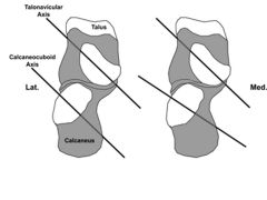The transverse tarsal (Chopart) joints consist of the talonavicular and calcaneocuboid joints. The transverse tarsal axes are parallel during most of the heel strike phase when the subtalar joint is everted.Incorrect Answers:
Answer 1: Eversion o...
