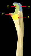 What are the names of  the four features of the proximal end of the Ulna?