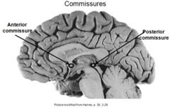 Commissural fibers connecting cerebral hemispheres