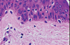 What are the clear cells in the basil layer?