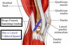 biceps femoris tendon