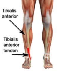 anterior tibialis tendons