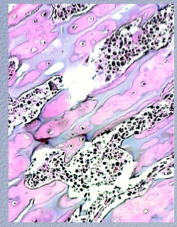What is shown here? Comment on trabeculae, cartilage. Number of osteoclasts? What is in the marrow cavities?