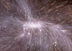 An owner brings jimmy into your practice who is presented to you because hes constantly itching and its driving his owner bonkers.
On examination of Jimmy you notice white dandruff that appears to walk. What is the likely cause of this?
