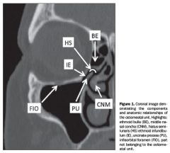 Is a crescent-shaped gap between the posterior free margin of the uncinate process and the anterior wall of the ethmoid bulla

Through this sagittaly oriented cleft or passageway the middle meatus communicates with the ethmoid infundibulum