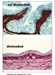 Urinary bladder

						Intercellular tight junctions between the
epithelial cells.
The epithelium changes appearance
depending on the volume of urine present in
the bladder.

					
				
			
		
	


The cell membranes of the
surface ce...