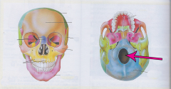 Latin for "Hole that is big"
Base of skull
Where the spinal cord passes
Only major opening in the cranium
Swelling of the brain due to trauma or infection can push the brainstem though ("herniation")