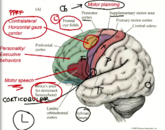 In green. It is the excess area that is past the motor cortexes in the frontal lobe