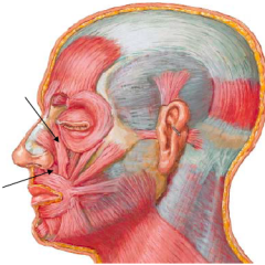 – Attachments:
• Frontal process of maxilla
• Alar cartilage
– Action
• Depresses ala laterally (dilates nasal aperture)
– Innervation: Buccal br. of facial nerve