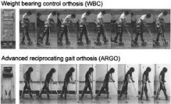 what is the gait pattern w/ RGO?