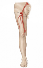 The main arterial supply to the lower limb.