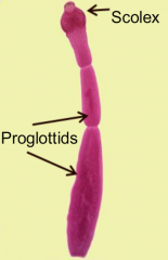 3 mm to 75 feet, 
multicellular, 
scolex, 
proglottids,
proglottids,