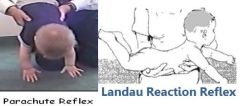 landau--


• present by 5-6 mos


• lift & extend neck & trunk


 


parachute


• present by 6-8 mos


• look for symmetric response


 


propping reflex--


• anterior propping when sitting


• lateral propping...