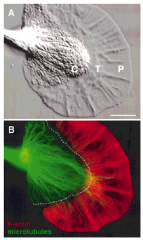 Periphery (drives movement):


Lamella (podium)


Filopodium


Centre:
Microtubules