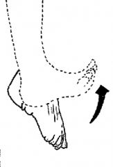 Flexion of the entire foot superiorly (point toes up)