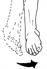 Movement of the sole towards the midline
Probably a rolled ankle