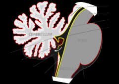 The choroid plexus is a plexus in the ventricles of the brain where cerebrospinal fluid (CSF) is produced. There are four choroid plexuses in the brain, one in each of the ventricles.