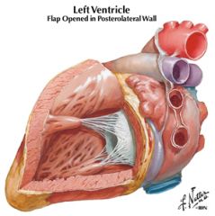 anterior papillary muscle (in left ventricle)