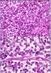 PNET:
 
Size, shape, color of cells,
Many or few mitoses
Glycogen rich cytoplasm may appear ______. 
Typically in _______ sheets of cells.
May have prominent ________ in a geographic pattern.